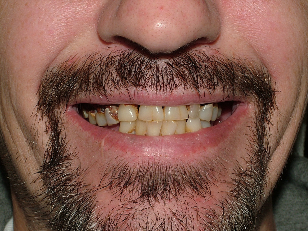 K1 before