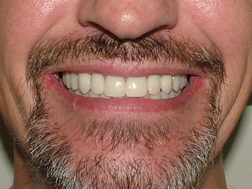 K2 after
